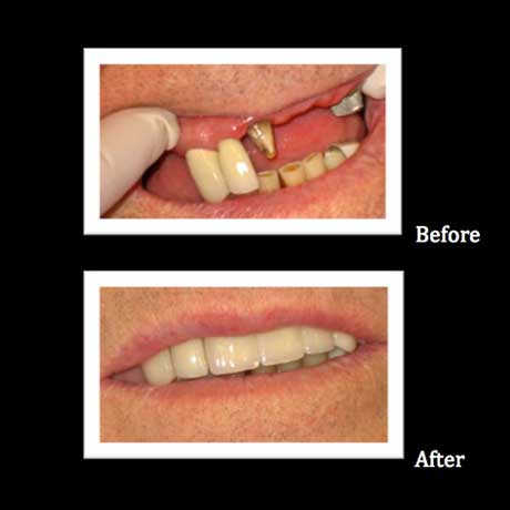 Granger Dentistry | Dental Lab, Orthodontics and E4D