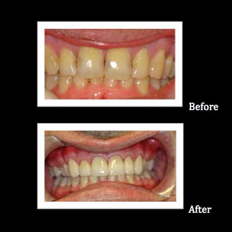 Granger Dentistry | ClearCorrect reg , All-on-4 reg  and Botox reg 