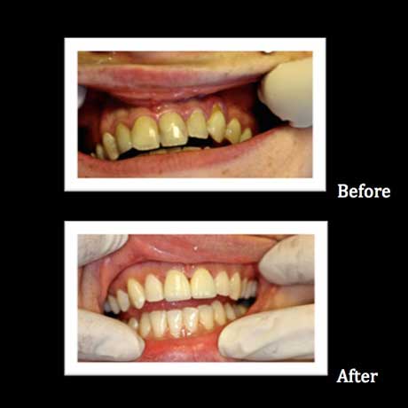 Healthy Teeth Family Dentistry | Sedation Dentistry, Dental Fillings and Preventative Program